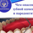 Чем опасен зубной камень и пародонтит? - Ейск.Инфо